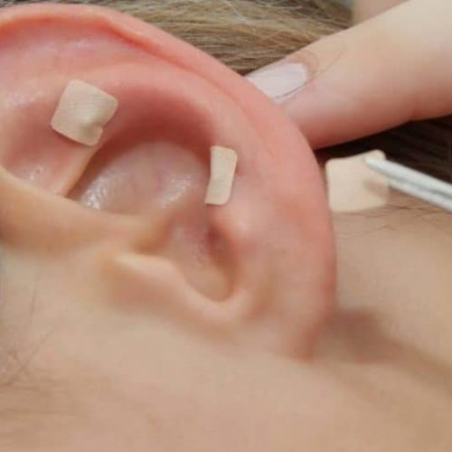 CURSO DE AURICULOTERAPIA