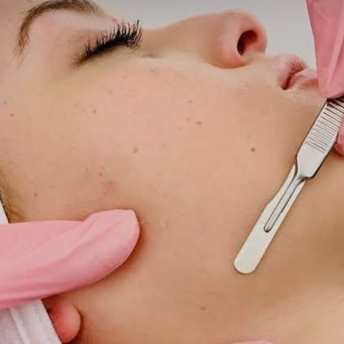 DERMAPLANING